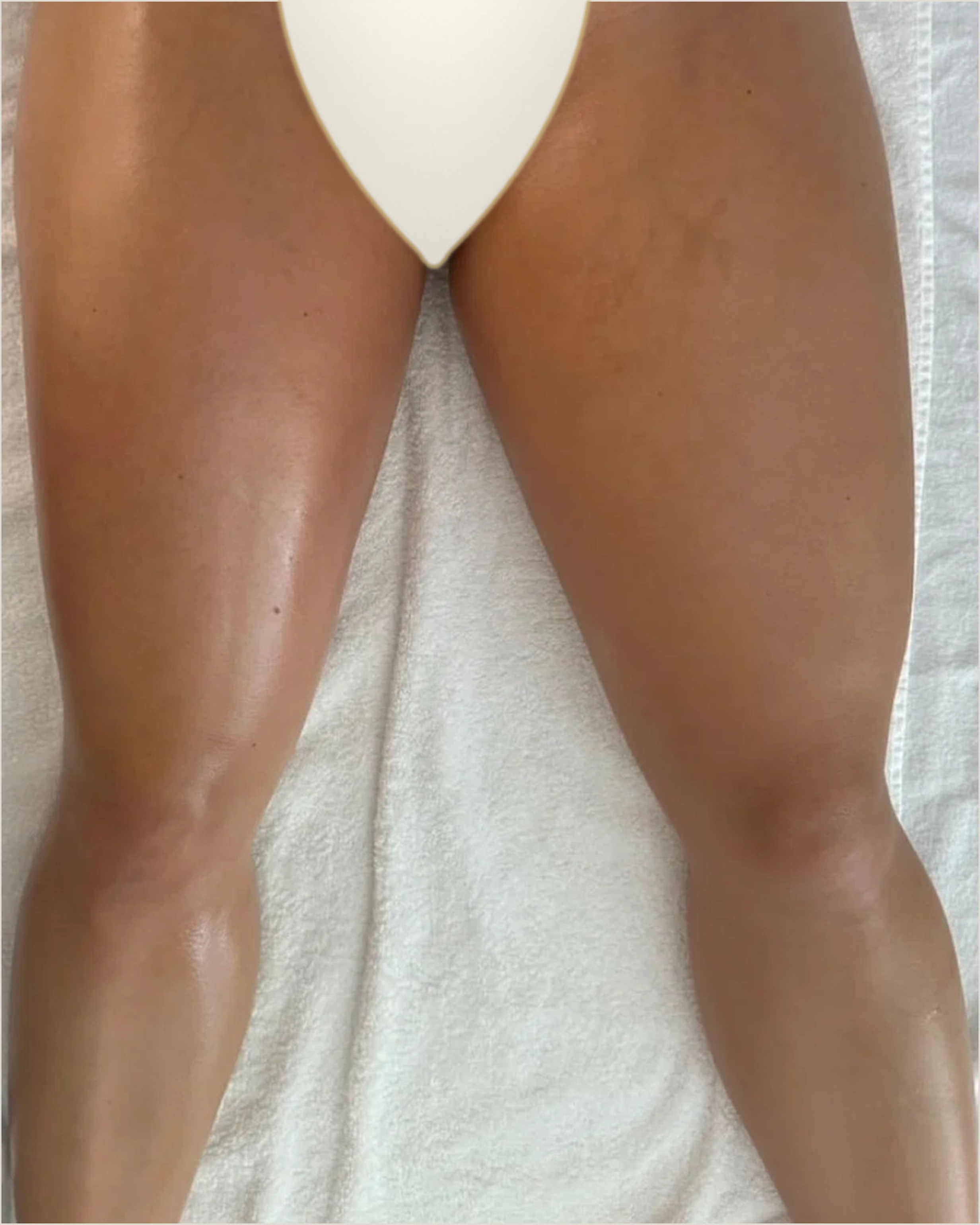 NOMI SCULPT Legs & Glutes — real client, treated left leg compared with untreated right leg
